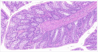 对机体结肠组织的影响(图4)