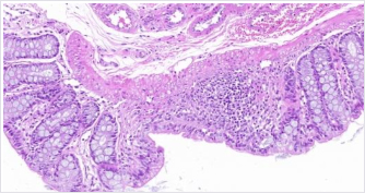 对机体结肠组织的影响(图6)