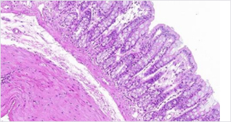 对机体结肠组织的影响(图7)