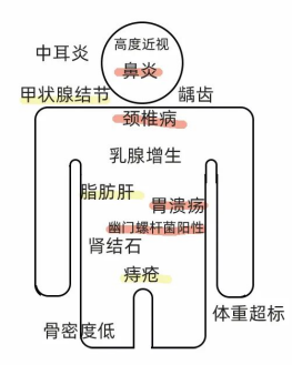 抑制幽门螺杆菌新方案——后生元Postbiocare®（附：最新共识推荐方案）